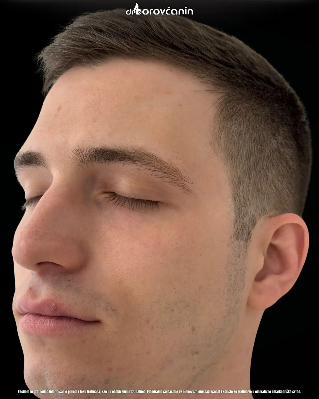 Polinukleotidi posle 2