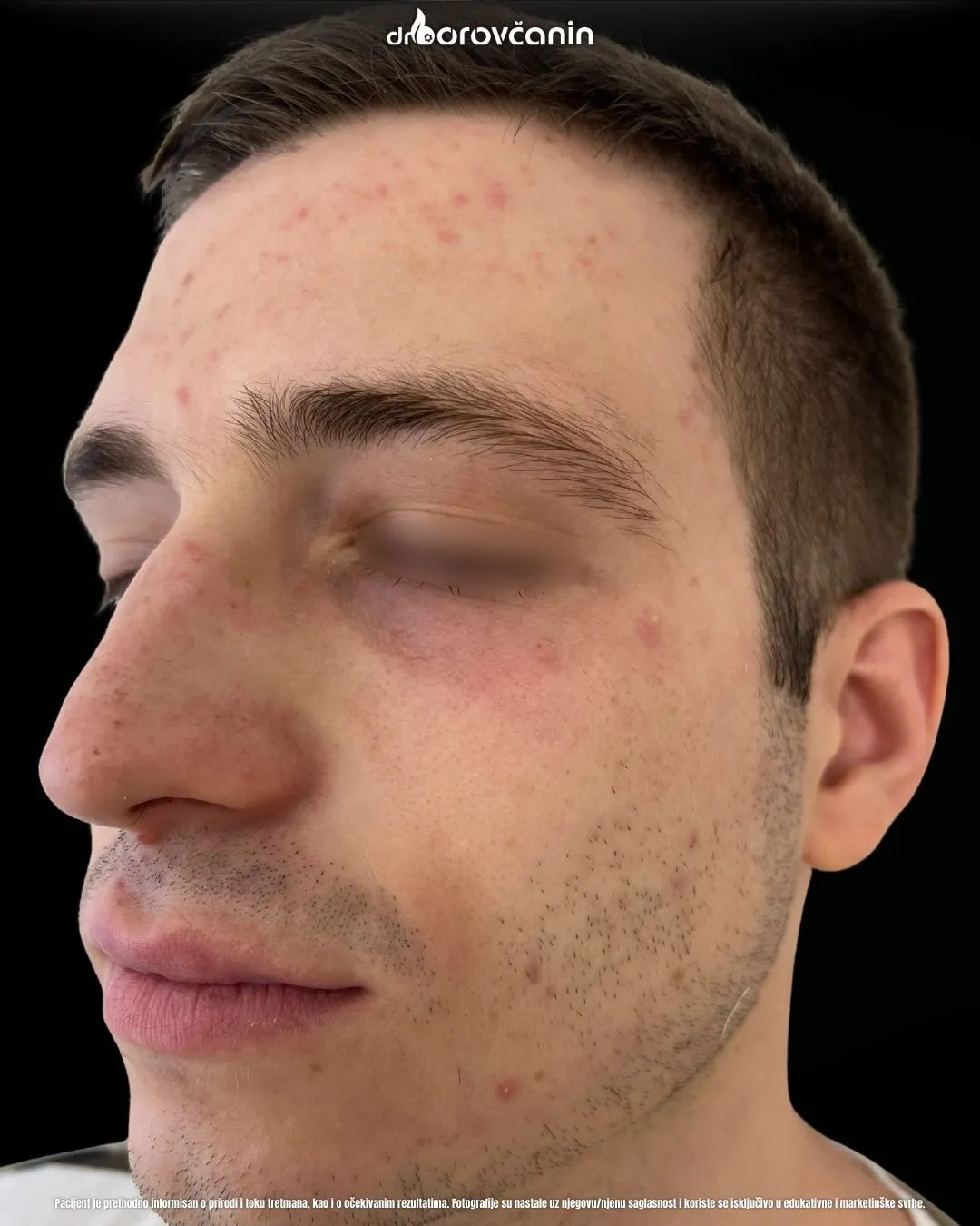 Polinukleotidi pre 2